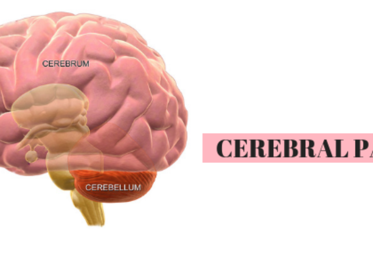 cerebral palsy children brain