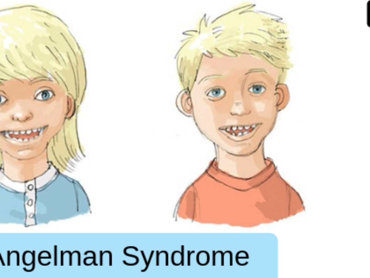 people with angelman syndrome